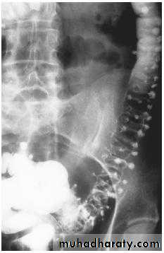 Imaging of GIT diseases