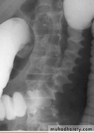 Imaging of GIT diseases
