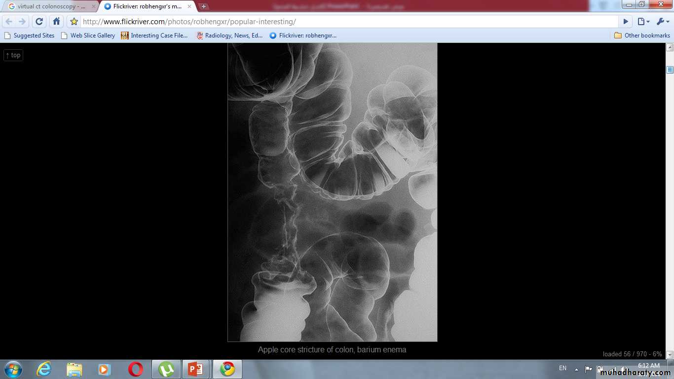 Imaging of GIT diseases
