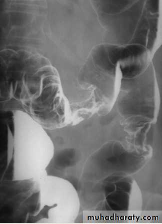 Imaging of GIT diseases