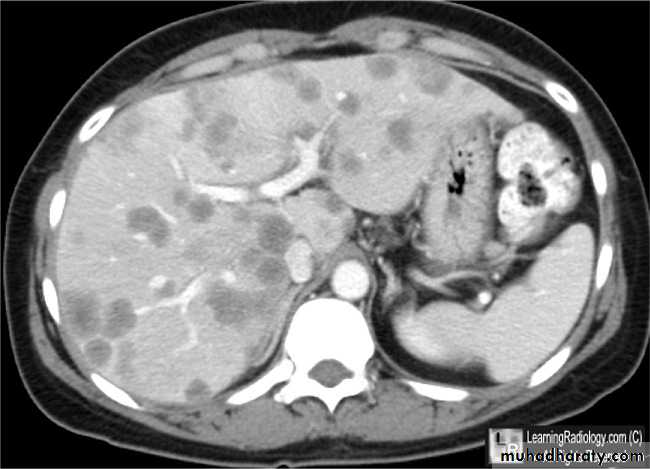 Imaging of GIT diseases