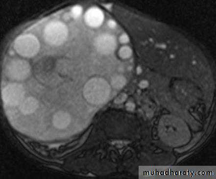Imaging of GIT diseases