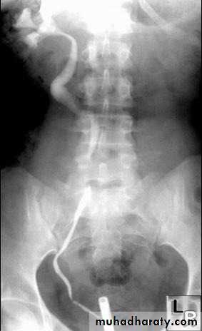 Imaging of urinary tract diseases