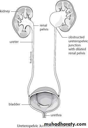 Imaging of urinary tract diseases