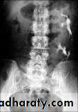 Imaging of urinary tract diseases