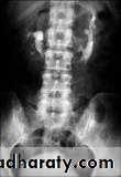 Imaging of urinary tract diseases