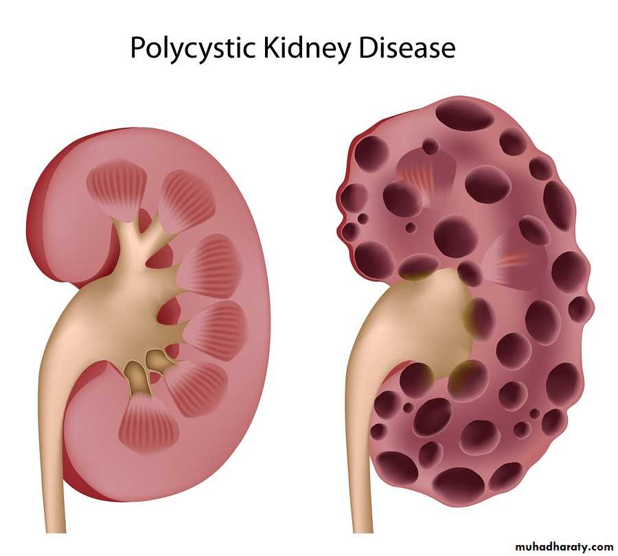 Imaging of urinary tract diseases