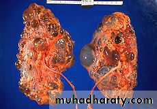Imaging of urinary tract diseases