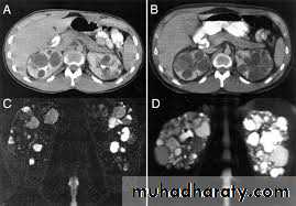 Imaging of urinary tract diseases