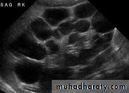 Imaging of urinary tract diseases