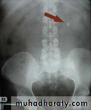 Imaging of urinary tract diseases