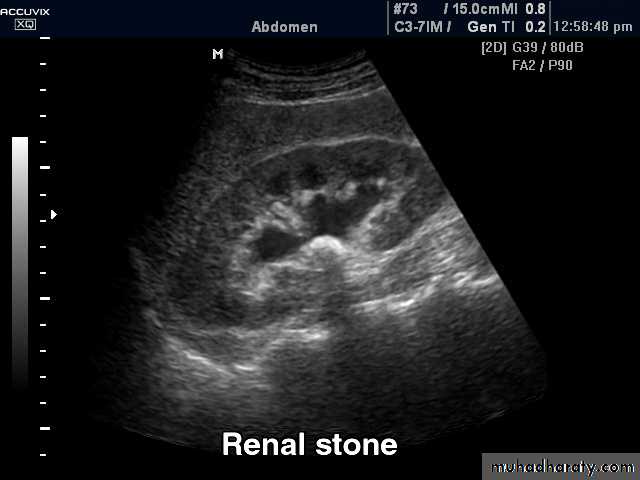 Imaging of urinary tract diseases