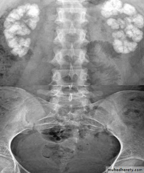 Imaging of urinary tract diseases