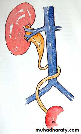 Imaging of urinary tract diseases