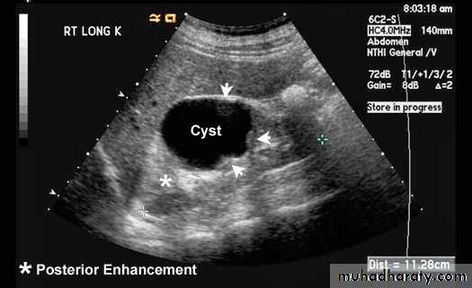Imaging of urinary tract diseases