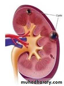 Imaging of urinary tract diseases
