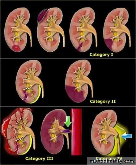 Imaging of urinary tract diseases