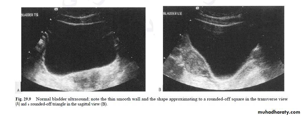 Imaging of urinary tract diseases