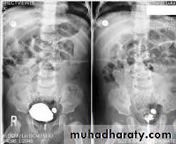 Imaging of urinary tract diseases