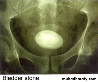 Imaging of urinary tract diseases
