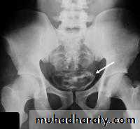 Imaging of urinary tract diseases