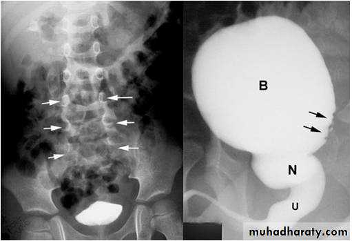 Imaging of urinary tract diseases