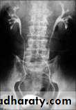 Imaging of urinary tract diseases