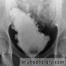 Imaging of urinary tract diseases