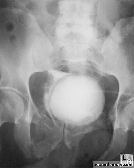 Imaging of urinary tract diseases
