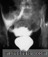 Imaging of urinary tract diseases