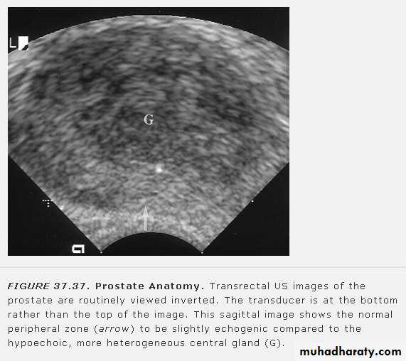 Imaging of urinary tract diseases