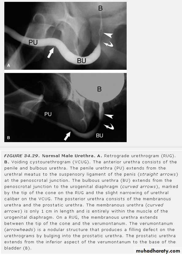 Imaging of urinary tract diseases