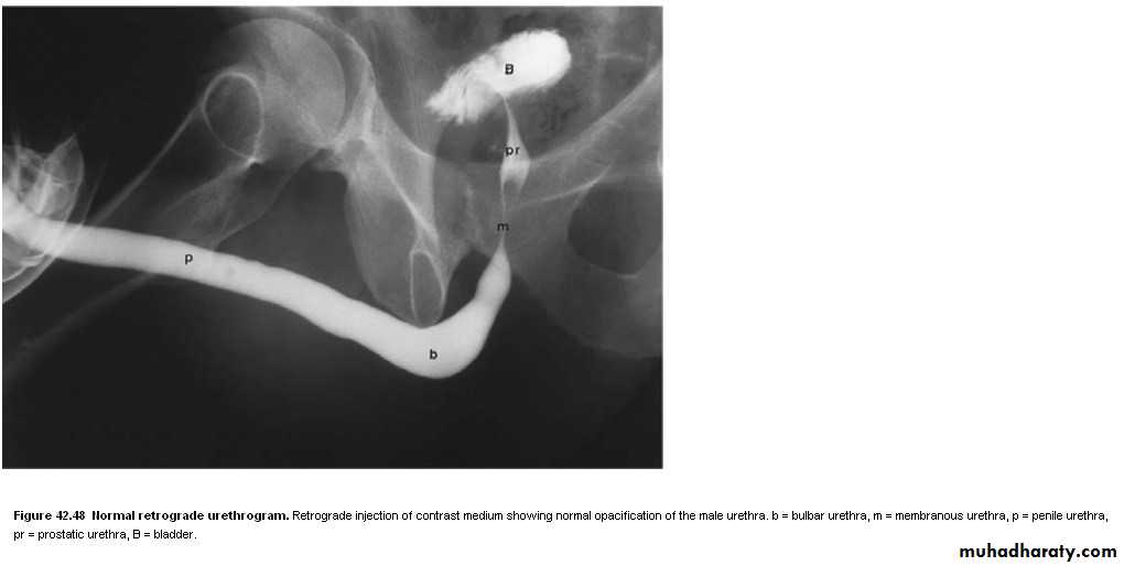 Imaging of urinary tract diseases