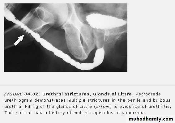 Imaging of urinary tract diseases