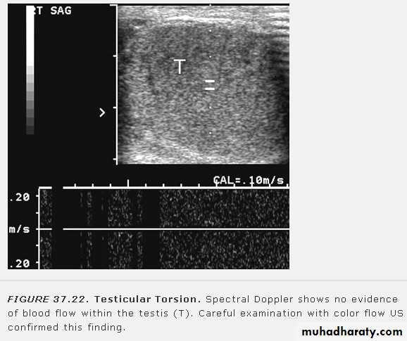 Imaging of urinary tract diseases
