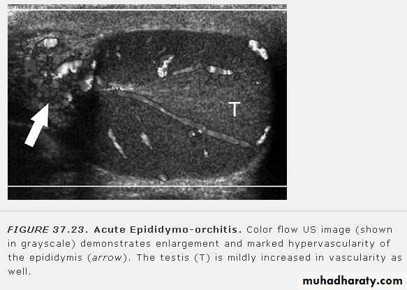 Imaging of urinary tract diseases