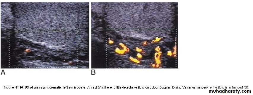 Imaging of urinary tract diseases