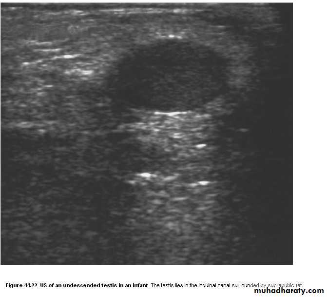 Imaging of urinary tract diseases