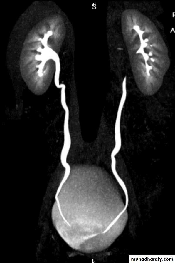 Imaging of urinary tract diseases