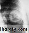 Trachea and bronchi