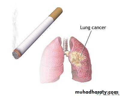 DDx of solitary lung lesion including lung abscess and Hydatid cyst and Tb