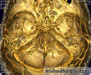 Intracranial hemorrhage