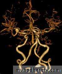 Intracranial hemorrhage
