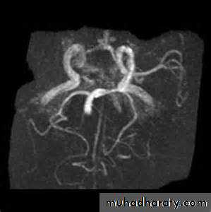Intracranial hemorrhage