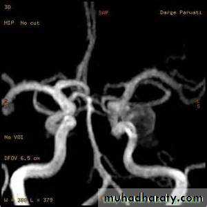 Intracranial hemorrhage