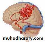 Intracranial hemorrhage