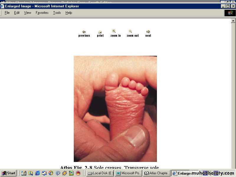 Neonatology