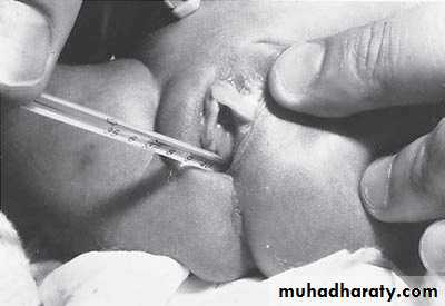 Pediatric surgery