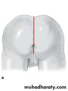 Pediatric surgery