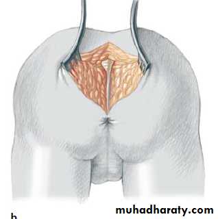 Pediatric surgery